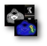 MSF: radiation therapy