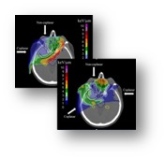 MSF: In silico clinical trials